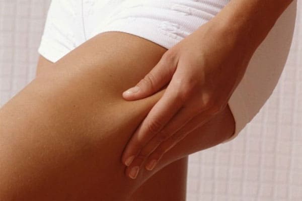 way erase cellulite