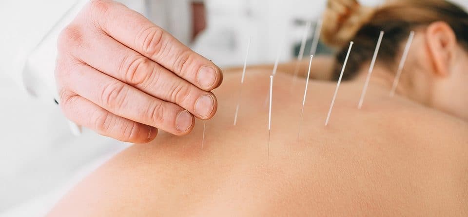 can acupuncture help
