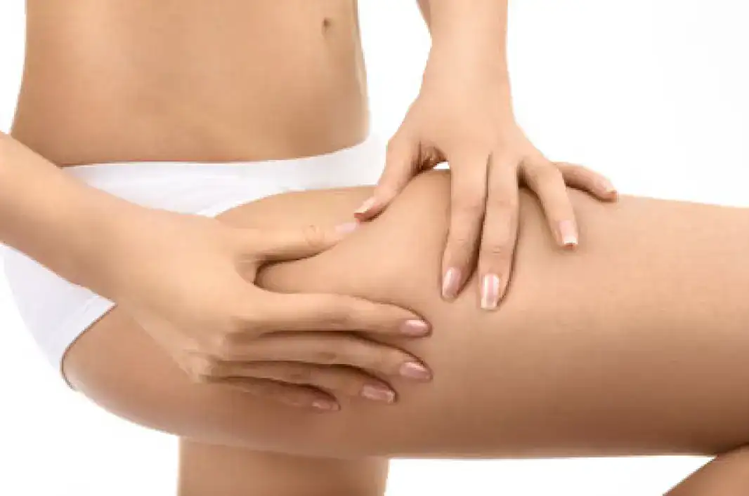 erase cellulite surprising
