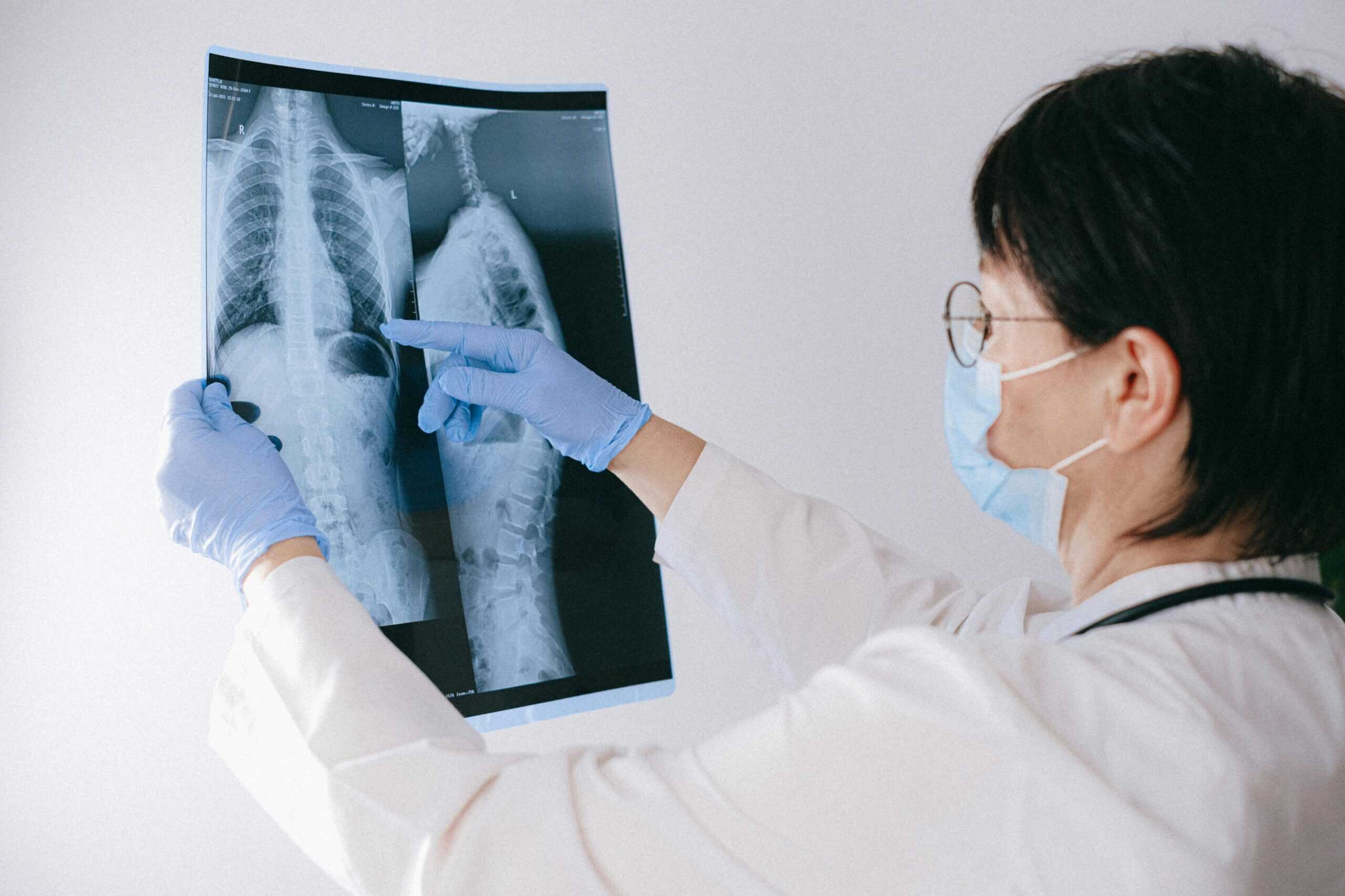 interstitial lung disease