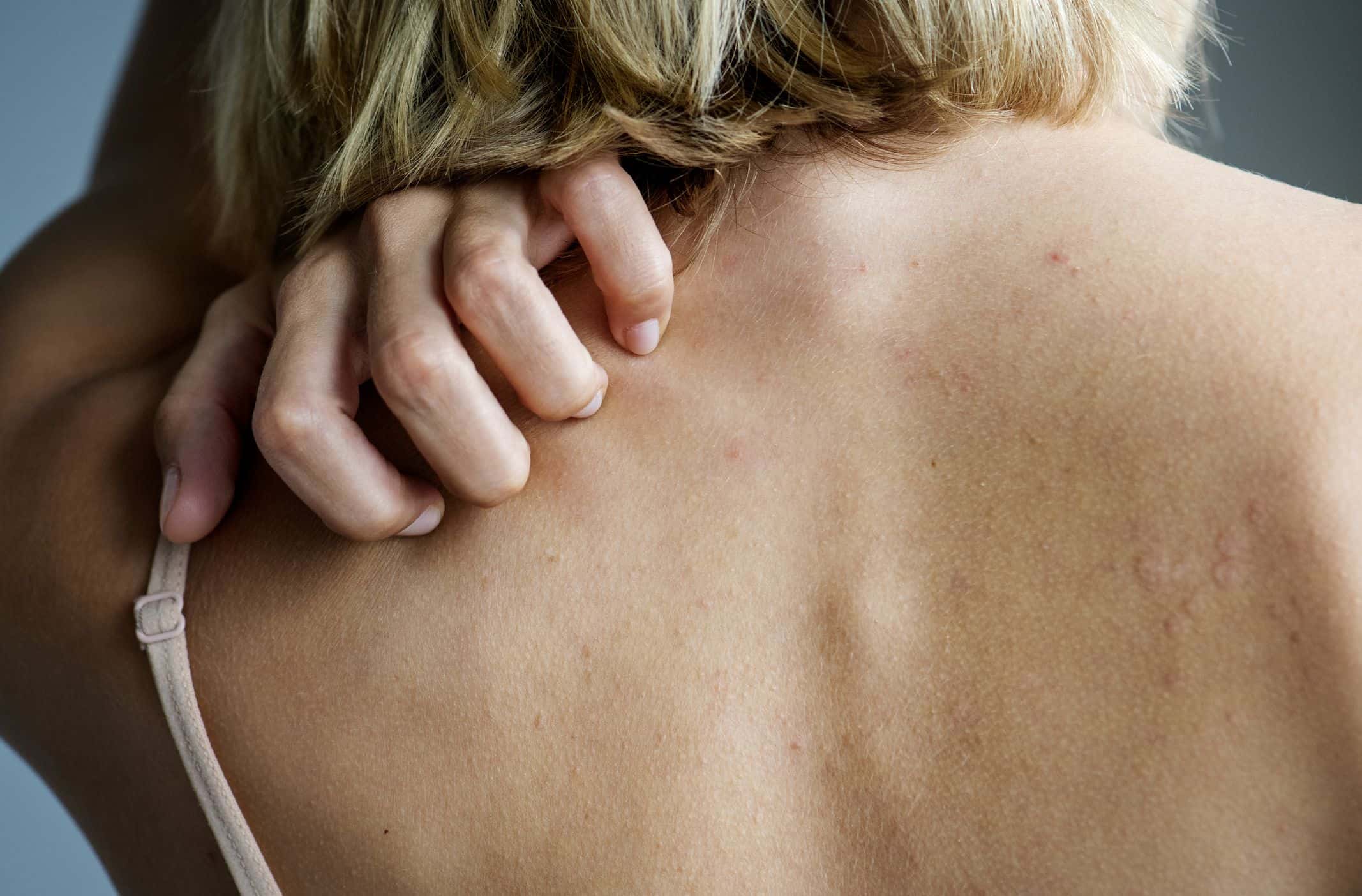 your skin overly