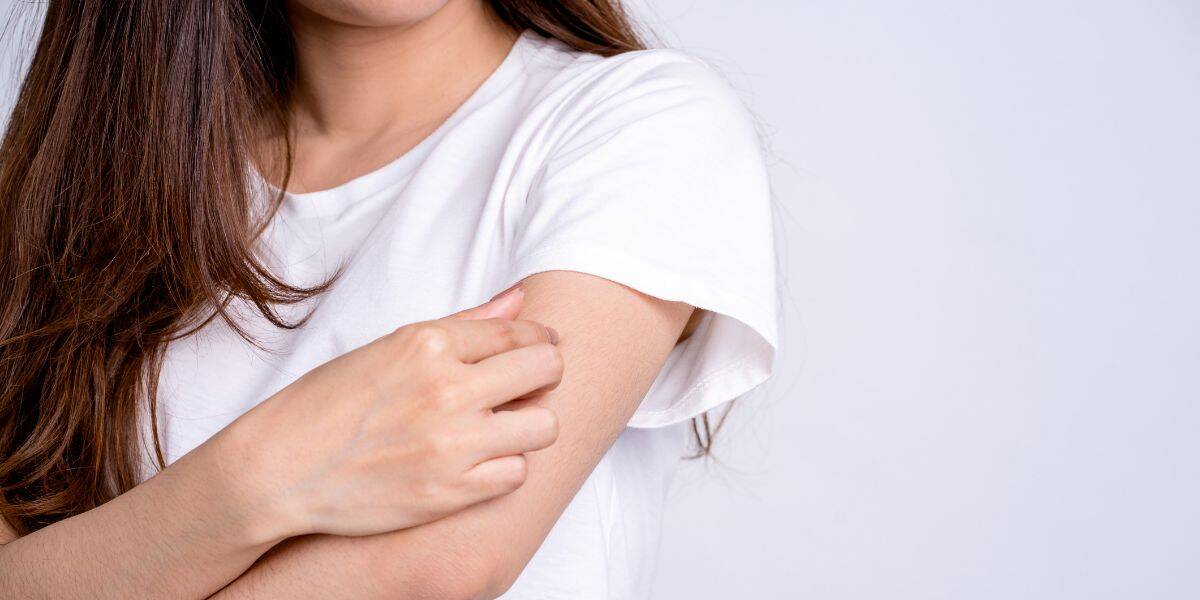 mosquito bites remedies