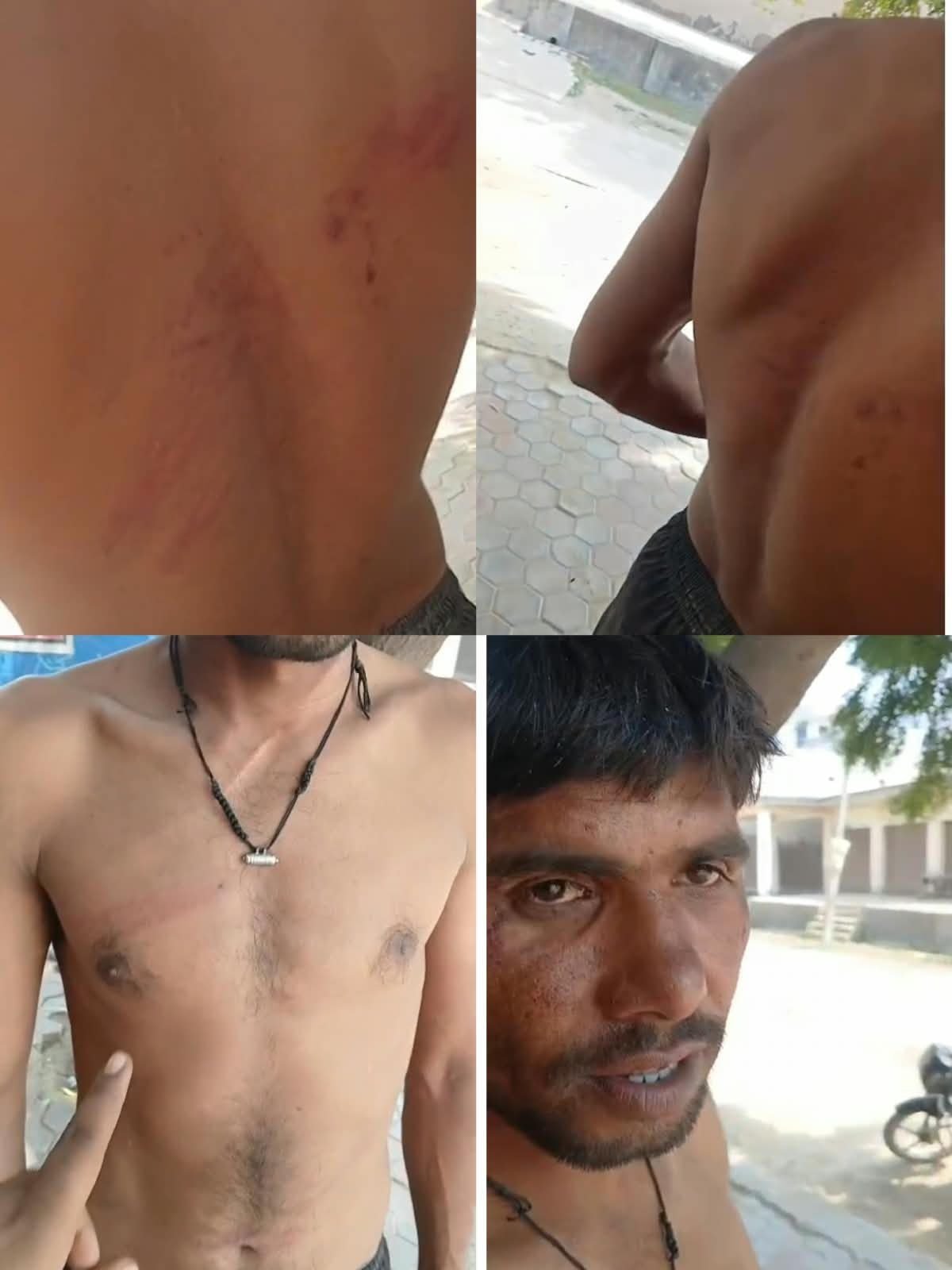 आधी रात बच्चों के विवाद ने लिया हिंसक रूप, घर में तोड़फोड़ और मारपीट का आरोप; युवक का दावा पुलिस ने भाई को बाहर ले जाकर पीटा, दोनों के मोबाइल भी ले गई