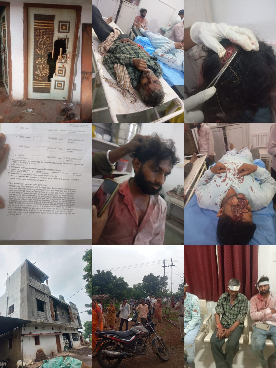 सरकारी जमीन के विवाद में घर पर हमला, पांच लोगों पर मारपीट का आरोप; दरवाजा तोड़कर घुसे, जान से मारने की धमकी देने का दावा