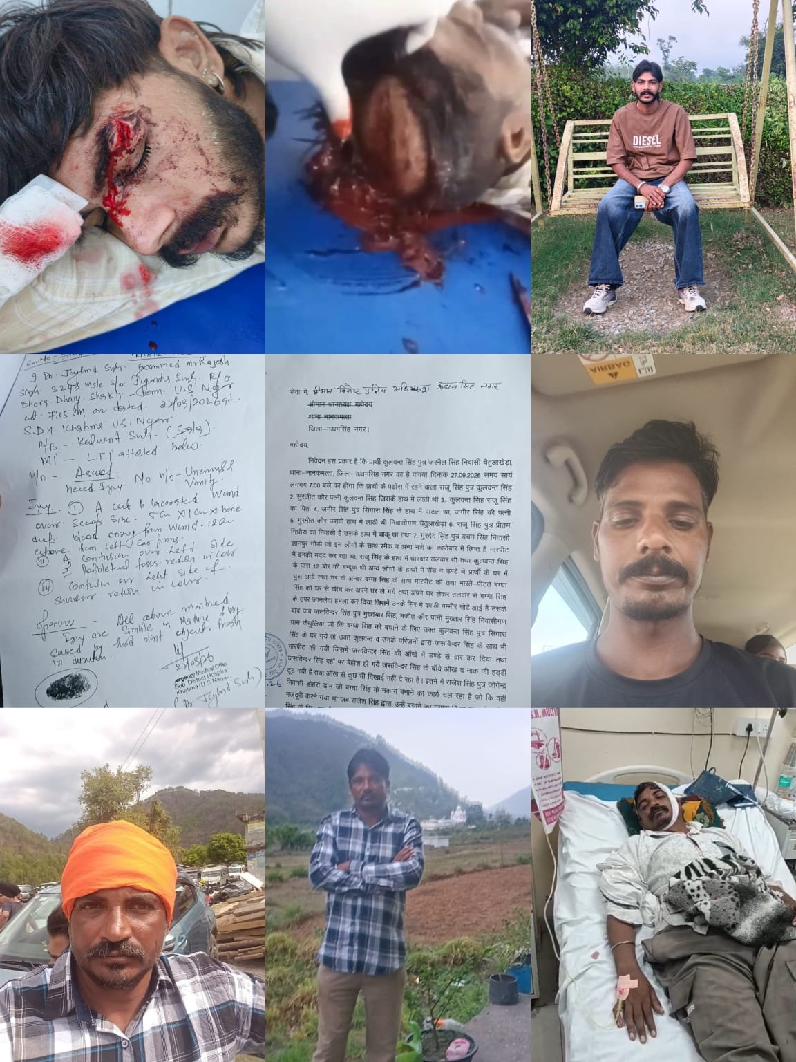 नानकमत्ता में घर में घुसकर मारपीट का आरोप, तलवार के हमले में बग्गा सिंह गंभीर; जसविंदर की नाक की हड्डी टूटी, राजेश के सिर में आए टांके