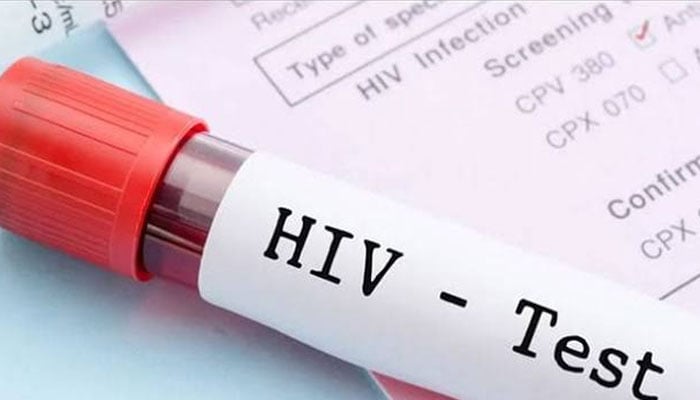 hivpositive children pakistan