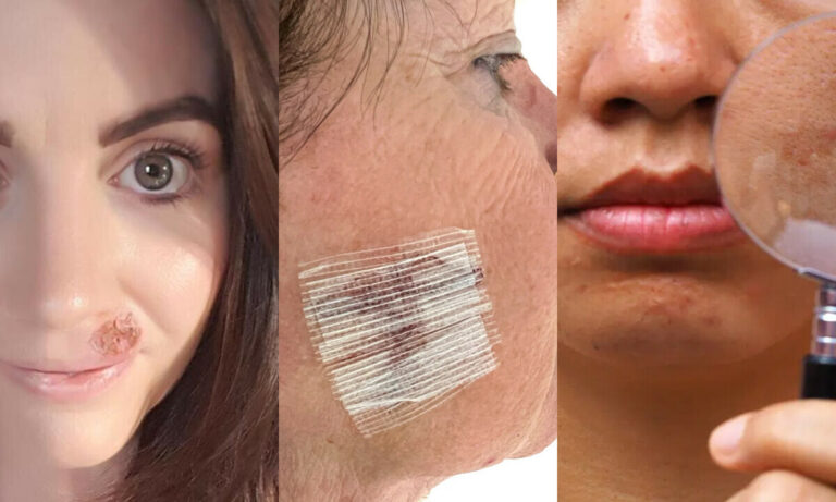 skin cancer warning