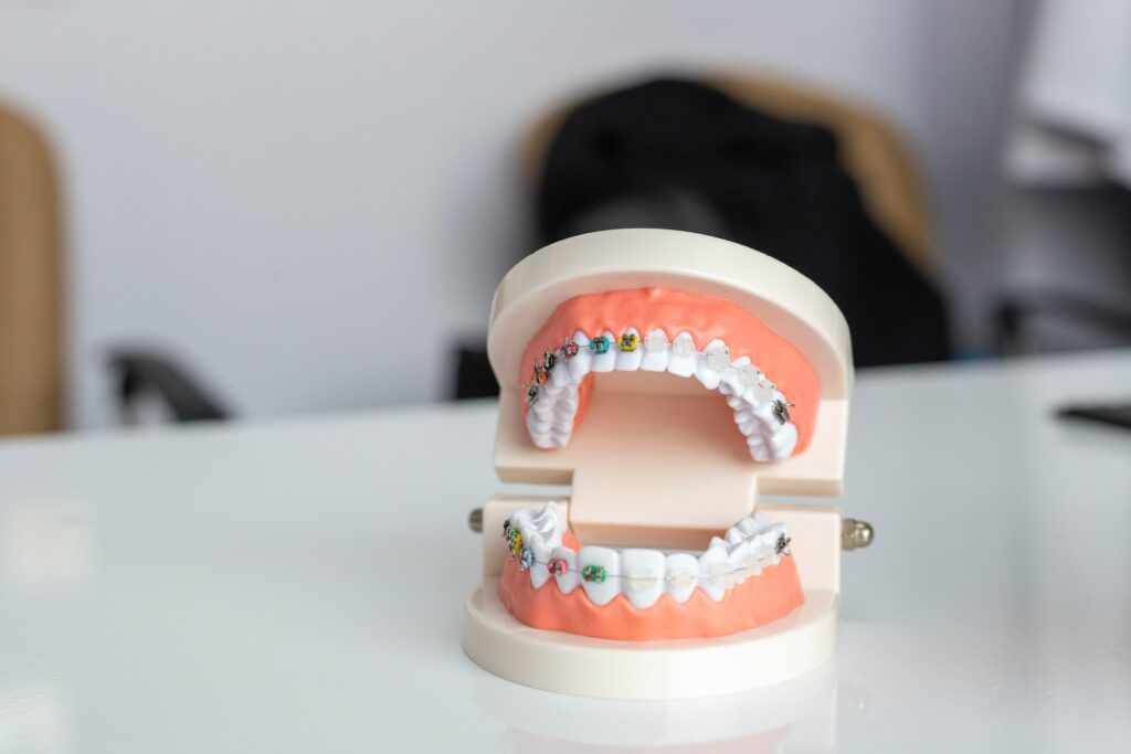 crooked teeth