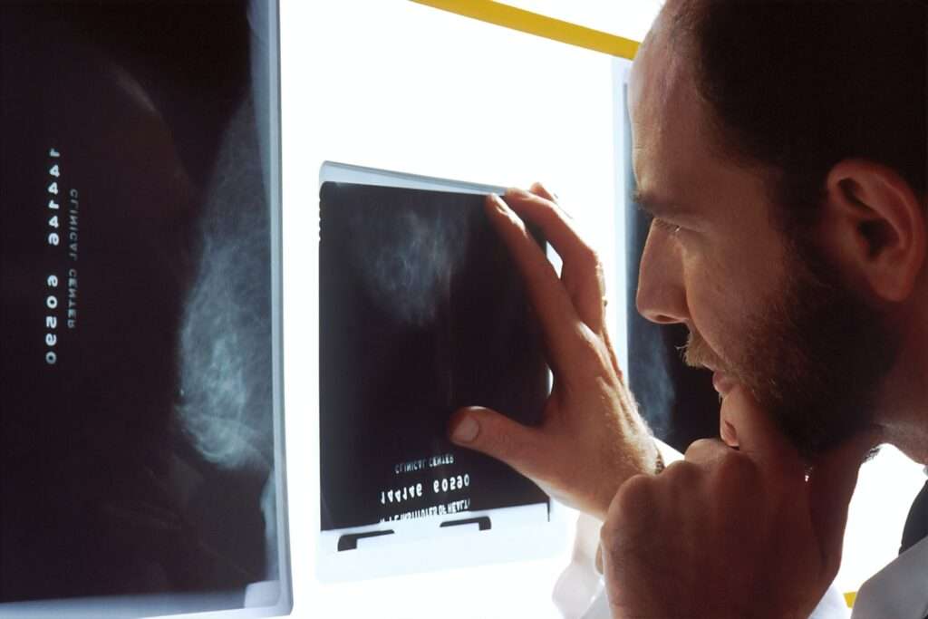 Fluoroscopy Mobile