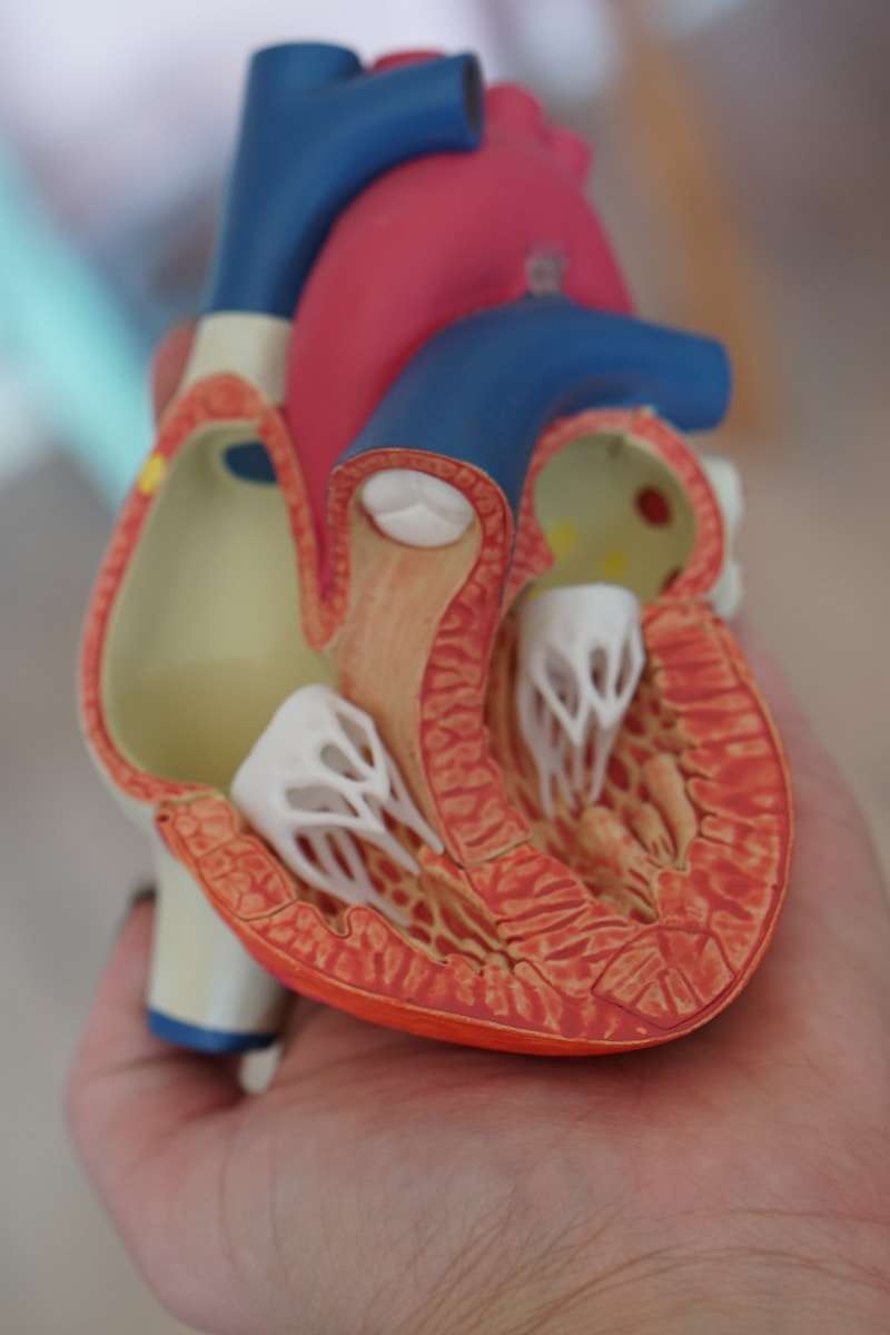 Artificial Organ