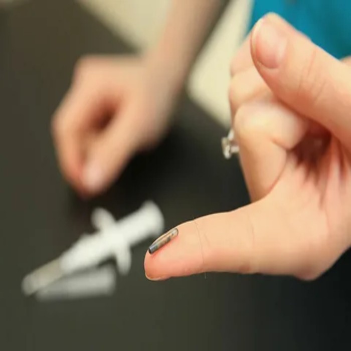 Human Microchipping Market (1)